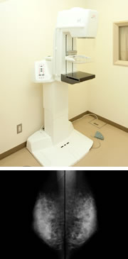 乳房撮影装置のイメージ