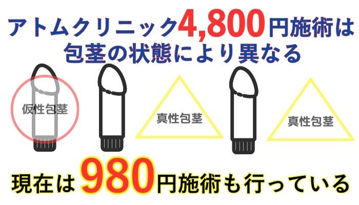 アトムクリニックAND美容外科 名古屋院の4,800円は嘘？実際の真実